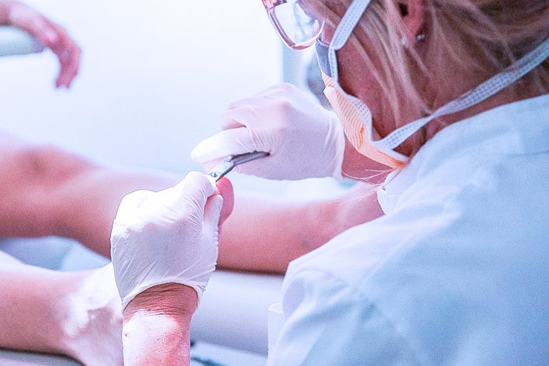 MM-QUIROPODOLOFGIA-UÑA